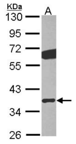 GNB2 Antibody, Novus Biologicals 0.1mL; Unlabeled:Antibodies, Polyclonal