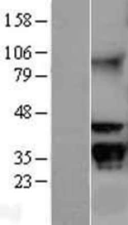 Novus Biologicals&trade;&nbsp;RACK1/GNB2L1 Overexpression Lysate