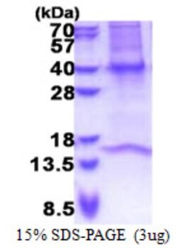 Novus Biologicals&trade;&nbsp;Recombinant Human GNB3 His Protein