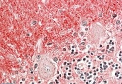 GNB3 Antibody, Novus Biologicals 0.1 mg | Buy Online | Novus Biologicals | Fisher Scientific