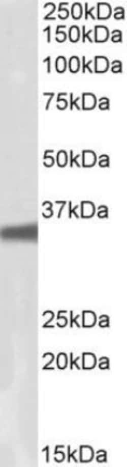 GNB3 Antibody, Novus Biologicals 0.1 mg | Buy Online | Novus Biologicals | Fisher Scientific
