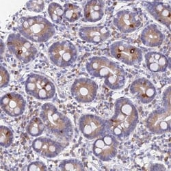 GNG13 Antibody, Novus Biologicals 0.1mL; Unlabeled:Antibodies, Polyclonal