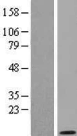 Novus Biologicals&trade;&nbsp;GNG2 Overexpression Lysate