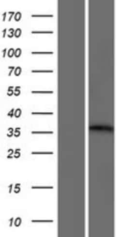Novus Biologicals&trade;&nbsp;GNIP Overexpression Lysate