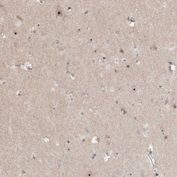 GNL3L Antibody, Novus Biologicals:Antibodies:Primary Antibodies