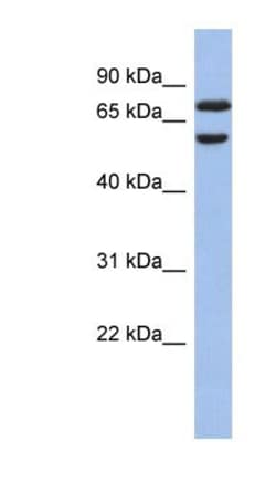 GNL3L Antibody, Novus Biologicals 100&mu;L; Unlabeled:Antibodies, Polyclonal