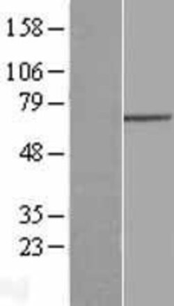 Novus Biologicals&trade;&nbsp;GNPAT Overexpression Lysate