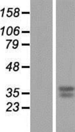 Novus Biologicals&trade;&nbsp;GNPDA1 Overexpression Lysate
