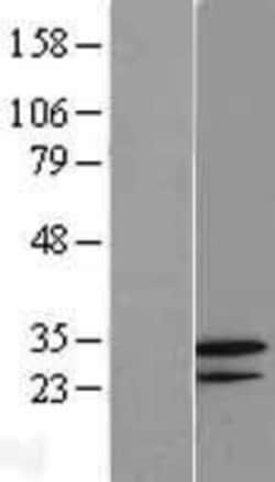Novus Biologicals&trade;&nbsp;GNPDA2 Overexpression Lysate