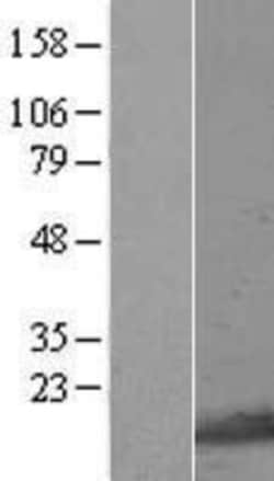 Novus Biologicals&trade;&nbsp;GNRPX Overexpression Lysate