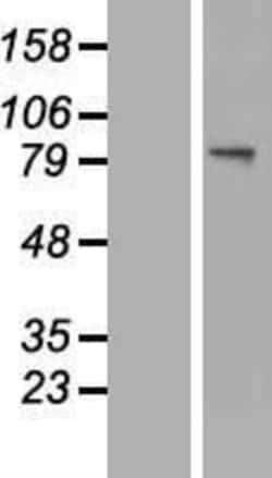 Novus Biologicals&trade;&nbsp;Glucosamine (N-acetyl)-6-Sulfatase/GNS Overexpression Lysate