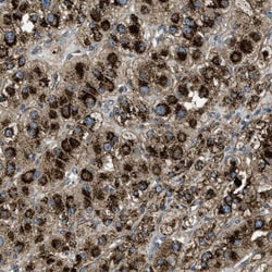 Glucosamine (N-acetyl)-6-Sulfatase/GNS Antibody, Novus Biologicals 0.1mL;