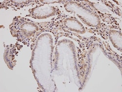 GOLGA3 Antibody, Novus Biologicals 0.1mg; Unlabeled:Antibodies, Polyclonal