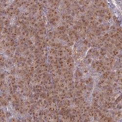 GOLGA3 Antibody, Novus Biologicals 0.1mL; Unlabeled:Antibodies, Polyclonal