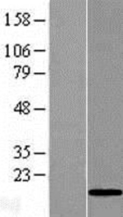 Novus Biologicals™ GOLGA7B Overexpression Lysate