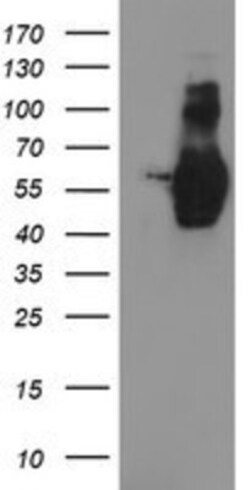 GOLM1 Antibody (OTI4B12), Novus Biologicals 0.1mL; Unlabeled:Antibodies,