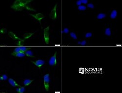 GOLM1 Antibody, Novus Biologicals:Antibodies:Primary Antibodies