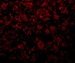 GOLM1 Antibody - BSA Free, Novus Biologicals 0.025 mg, Unconjugated:Antibodies,