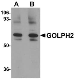 GOLM1 Antibody - BSA Free, Novus Biologicals 0.025 mg, Unconjugated:Antibodies,