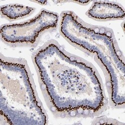 GOLPH4 Antibody, Novus Biologicals 25 &mu;L, Unconjugated:Antibodies, Polyclonal