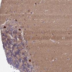 Gonadotropin Inducible Transcription Repressor 1 Antibody, Novus Biologicals