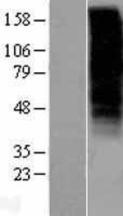 Novus Biologicals&trade;&nbsp;GnRHR Overexpression Lysate