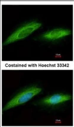GO Protein alpha Antibody, Novus Biologicals 0.1mL; Unlabeled:Antibodies,