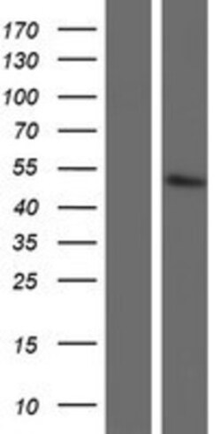 Novus Biologicals™ GOT1L1 Overexpression Lysate