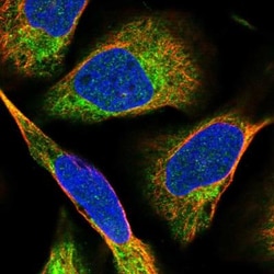 GOT1L1 Antibody, Novus Biologicals 25 &mu;L, Unlabeled:Antibodies, Polyclonal