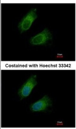 GOT2 Antibody, Novus Biologicals 0.1mL; Unlabeled:Antibodies, Polyclonal