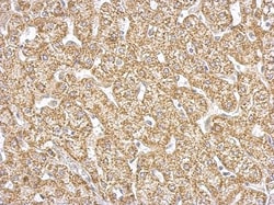 GOT2 Antibody, Novus Biologicals 0.1mL; Unlabeled:Antibodies, Polyclonal