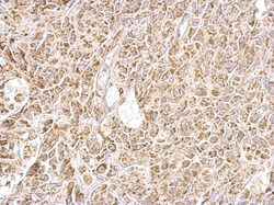 GOT2 Antibody, Novus Biologicals 0.1mL; Unlabeled:Antibodies, Polyclonal
