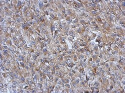 GOT2 Antibody, Novus Biologicals 0.1mL; Unlabeled:Antibodies, Polyclonal