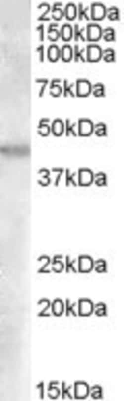 GOT2 Antibody, Novus Biologicals 0.1mg; Unlabeled:Antibodies, Polyclonal