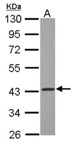 GOT2 Antibody, Novus Biologicals 0.1mL; Unlabeled:Antibodies, Polyclonal