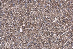 GOT2 Antibody, Novus Biologicals 0.1mL; Unlabeled:Antibodies, Polyclonal