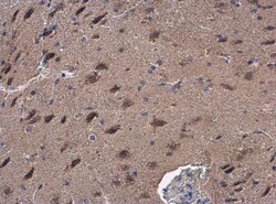 GOT2 Antibody, Novus Biologicals 0.1mL; Unlabeled:Antibodies, Polyclonal