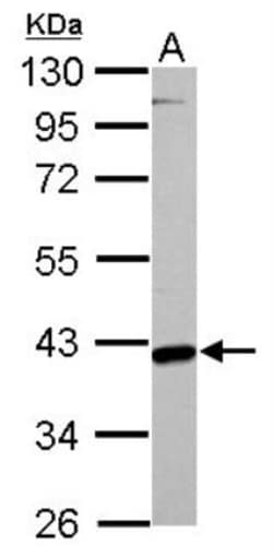 GOT2 Antibody, Novus Biologicals 0.1mL; Unlabeled:Antibodies, Polyclonal