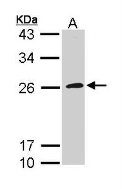 GP1BB Antibody, Novus Biologicals 0.1mL; Unlabeled:Antibodies, Polyclonal
