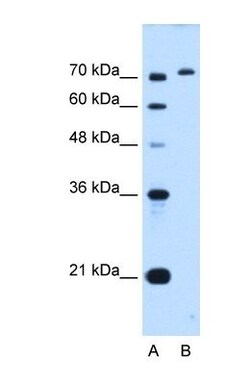 GPAA1 Antibody, Novus Biologicals 100&mu;L; Unlabeled:Antibodies, Polyclonal