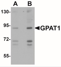 GPAM Antibody - BSA Free, Novus Biologicals 0.1mg; Unlabeled:Antibodies,