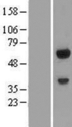 Novus Biologicals&trade;&nbsp;GPATCH2L Overexpression Lysate
