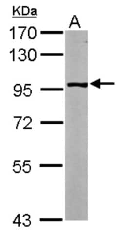 Glycogen Phosphorylase BB/GPBB Antibody, Novus Biologicals 0.1mL; Unlabeled:Antibodies,