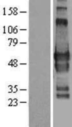 Novus Biologicals&trade;&nbsp;GPBP1L1 Overexpression Lysate