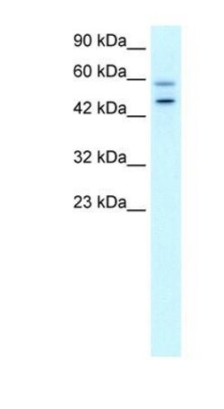 GPBP Antibody, Novus Biologicals:Antibodies:Primary Antibodies