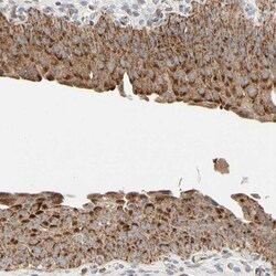 GPD2 Antibody, Novus Biologicals 25 &mu;L; Unlabeled:Antibodies, Polyclonal
