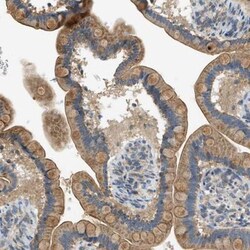 GPI7 Antibody, Novus Biologicals 25 &mu;L; Unlabeled:Antibodies, Polyclonal