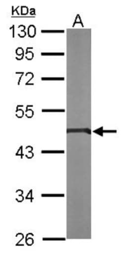 GPI8 Antibody, Novus Biologicals 0.1mL; Unlabeled:Antibodies, Polyclonal