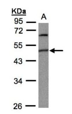 GPI8 Antibody, Novus Biologicals 0.1mL; Unlabeled:Antibodies, Polyclonal