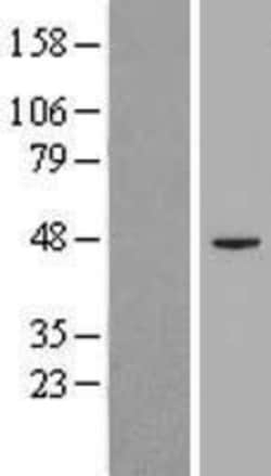 Novus Biologicals&trade;&nbsp;GPI8 Overexpression Lysate